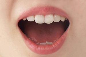 粉瘤の原因と治療法を徹底解説！信頼できる皮膚科クリニックの選び方ガイド