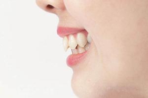 福山市で痩身エステに通いたいなら